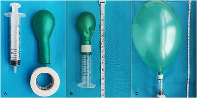 Modified Valsalva maneuver after burr-hole drainage of chronic subdural hematomas: A single-center cohort study